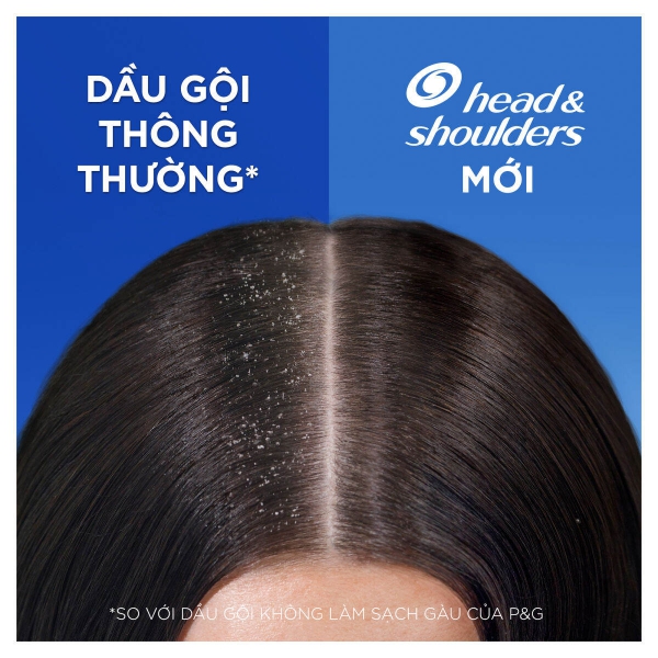 Combo 2 Chai Dầu Gội Head & Shoulders Bạc Hà Mát Lạnh - Sạch Gàu, Giảm Ngứa Da Đầu (1200ml)